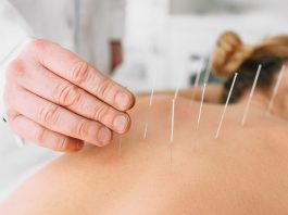 Acupuncture vs. Massage